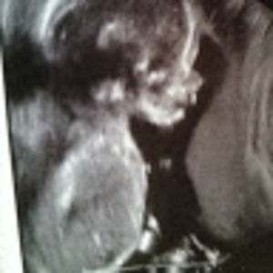 Meet your Posher, Putri